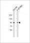NR3C1 [Knockout Validated]